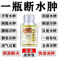 Remove Edema Medicine Lower Limb Edema Instep Floating Foot Edema Leg Edema Face Edema Limb Floating