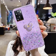 Cute 3D Mickey Phone Case for OPPO A57 4G A77 5G A96 A95 A76 2022 A16 A16K A16e A15 A15S A55 A54 A94 A93 A74 A53 A33 A52 A92 A9 A5 A31 2020 New Design Soft Protective Handphone Casing Cover Ready Stock