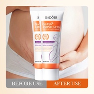 Penghilang Bekas Luka Stretch Mark penghilang strechmark 40G Krim Penghilang Stretch Mark Cream Peng