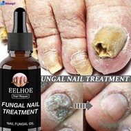 Eelhoe Nail Fungus Treatment Essence Serum Feet Care Anti Infection Nail Foot Toe Nail Fungus Remova