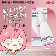 Liv Clindamycin Solution30ml Chest and Back Acne Antibacterial Anti-Inflammatory Acne Removing Clind