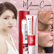 【Ready Stock】20G Melasma Cream Pekas Remover Collagen Japan Pekas Remover Original Pekas &amp; Freckles Remover Cream