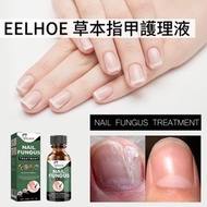 EELHOE草本指甲護理液腳甲護理液/腳甲受傷護理液/灰指甲修復液/厚軟甲修護液/指甲護理液/足部護理液/手足指甲修復滋養/腳甲修復【30ml】