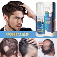 MELAO 5% Minoxidil Hair Mousse Menyuburkan Akar Rambut Menebalkan Rambut dan Menguatkan Rambut
