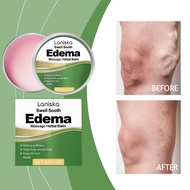 【Choice】 Edema Soothing & Healing Leg Balm Natural Ingredients Reduces Swelling Soothes Discomfort B