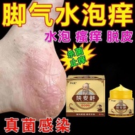 Athlete's Foot Anti-itching Peeling Sterilization Bad Athlete's Athlete's Athlete's Athlete's Athlet