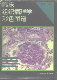 【金州書坊】全新現書－臨床組織病理學彩色圖譜--宋繼謁 編著 13碼ISBN：9787538120240
