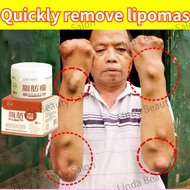 Original Lipoma Removal Cream Special Gel Removing Lipoma Subcutaneous Lipoma Lump Bulge Buang Ketua