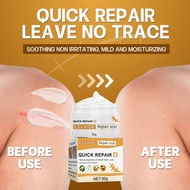 Scar Removal Cream | Acne Scar & Burn Treatment | Repairs Blackhead Acne Spots | Skincare Repair
