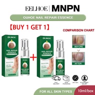 Eelhoe nail repair essence fungus toe treatment fungus Repair Cream Nail Cream damaged fungus nail r