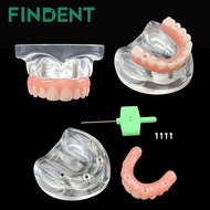 1Pcs Dental Maxillary Tooth Model With 4 Implant Pins Removable Restoration Implant Model For Dentis