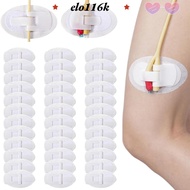 ELOK Catheter Fixation Sticker, Adhesive Breathable Urinary Tube Holders,  Disposable Stabilization 