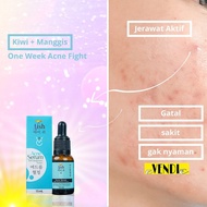 Aish Acne Care Serum 15ML\serum acne Berkualitas