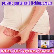 J12 Anti-itch cream Fast relief 30g man skin care cream antibacterial cream itching Allergies Quickly eliminate rashes Fungal infection Eliminates itching in the groin For men