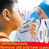 Dermatix Ultra Advanced Scar Formula Acne Scar Removal Cream Skin Repair Scars Burns Cuts Pregnancy 