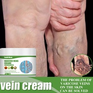 Varicose vein treatment cream Helps Varicose Veins Remover For Legs Veins Care for Varicose Veins Pr