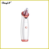 ♒ ஐ ◲ Ckeyin Blackhead Remover Electric Vacuum Suction Blackhead Extractor Clean Tool with 4 Probe