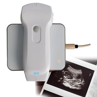 Highest Cost-Effective Double Probes Wireless Color Doppler Ultrasound Scanner Wireless Linear Ultra