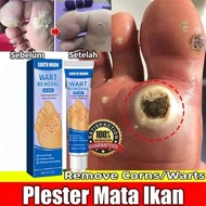 Wart cream remover, wart patch remover, corn granule remover, corn medication, corn removal eye oint