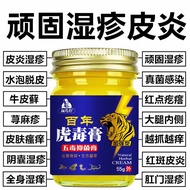 Century Tiger Venom Cream Naughty Dermatitis Eczema Hill Rash Eczema Eczema Eczema Eczema Blister Bl