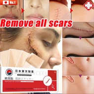 Japan Silicone Scar Sheet Scar Removal 3pcs/box Acne Scar Removal Lighten Surgical Scars, Keloid, Hy