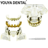4 Implant Nail Maxillary Sinus Detachable Research Teaching Dental Implant Model