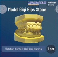 Model Gigi Gips / Model Study Gipsum Praktikum - Gips Kuning