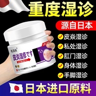 Eczema Cream Dermatitis Eczema Sweat Herpes Remove Dampness Eczematic Nettle Herpes Skin Itching Ant