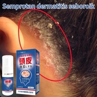 Seborrheic Dermatitis Spray 30ml Scalp Treatment Scalp Psoriasis Anti Dandruff Ubat Kulit Kepala Ber