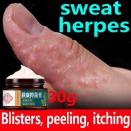 Antibacterial Cream Eczema Itchy Peeling Dermatitis Herpes Skin Therapy Healing Cream Psoriasis Crea