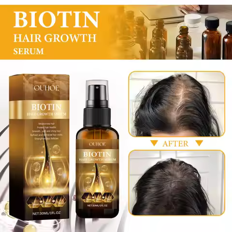 30ml Biotin Hair Growth ,Biotin Thickening Herbal,Biotin Hair Growth Spray For All Hair Type Partijb