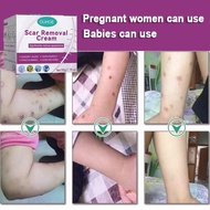 Scar Removal Cream Scar Removal Cream Foot Scar Repair Scar Removal Cream Repair Old Scars