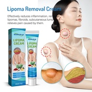 Lipoma Removal Cream Reduce Inflammation Anti-tumor Treatment Cyst Swelling Nodular Relief Pain Oint