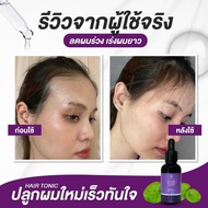 เซรั่มผม HAIR TONIC เซรั่ม โทนิค ชบา เข้มข้น เพิ่มคิ้ว หนวด ผมยาวขึ้น ของแท้ 100%