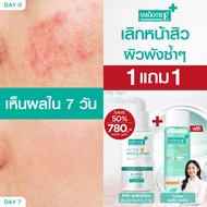 [เซ็ตสุดคุ้ม] Smooth E clear Whitening Toner & Acne Pro oil control serum เซ็ทสยบสิวซ้ำ ซ่อมผิวพัง ค