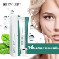 BREYLEE Acne Scar Removal Cream Fading Stretch Marks Scar Remover 30g