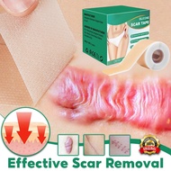 silicone scar sheet hilangkan parut jerawat acne scar tape scar removal keloid scar patch parut kaki