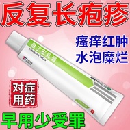 Snake Tray Winding Belt-Shaped Herpes] Spider Herpes Herpes Herpes Herpes Herpes Herpes Herpes Herpe