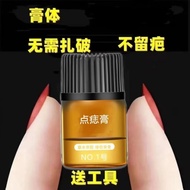 Mole Cream Mole Cream Mole Cream Facial Removal Black Mole Flesh Mole Flesh Mole Flesh Pellet Studen