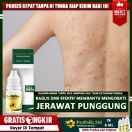 Obat Jerawat Punggung Pria Wanita Jerawat Punggung Dan Dada Jerawat Batu Di Punggung Penghilang Jera