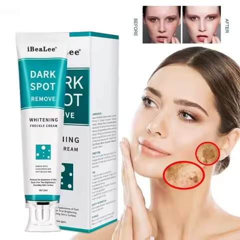 Whitening Freckle Cream Remove Dark Spots Remove Melasma Anti Freckle Cream Fade Pigmentation Anti-A