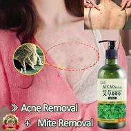 Acne shower gel relieves itching, removes mites, whitens, moisturizes, inhibits bacteria, soothes it