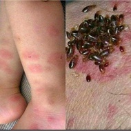 SPRAY UBAT PEPIJAT | BEDBUGS | CAMAY REPELLENT TIADA BAU.BERKESAN