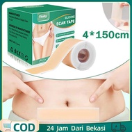 Scar Sheet Silicone 4cm X 1.5m Elaimei Silicone Scar Sheets / Scar Patch / Silicon Scar Sheet / Sili