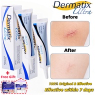 Dermatix Ultra Scar Gel 15g Dermatic Acne Scar Reduction Cream Advance Gel Scar Formula Reduce Deep 