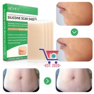 Aliver/Elaimei Silicone Scar Sheets 4pcs Per Box /ALIVER/Elaimei 新品硅胶疤痕贴 一盒4贴