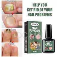 大熱産品 - EELHOE [15ml] 指甲修復液 針對菌 增厚灰指甲修護液 美甲營養護理液 足部護理液 指甲修復 指甲滋養 腳甲修復 [平行進口]