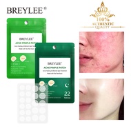 BREYLEE Acne Pimple Patch Acne Treatment Stickers Pimple Remover Tool  Skin Care Acne face Mask