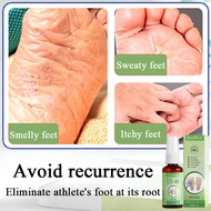 foot deodorant foot spray deodorant athelete foot 30ml Athlete's foot peeling blisters erosion itchi