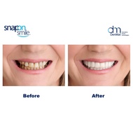 Snap On Smile 100% Authentic / Snap 'n Smile DD Dentures